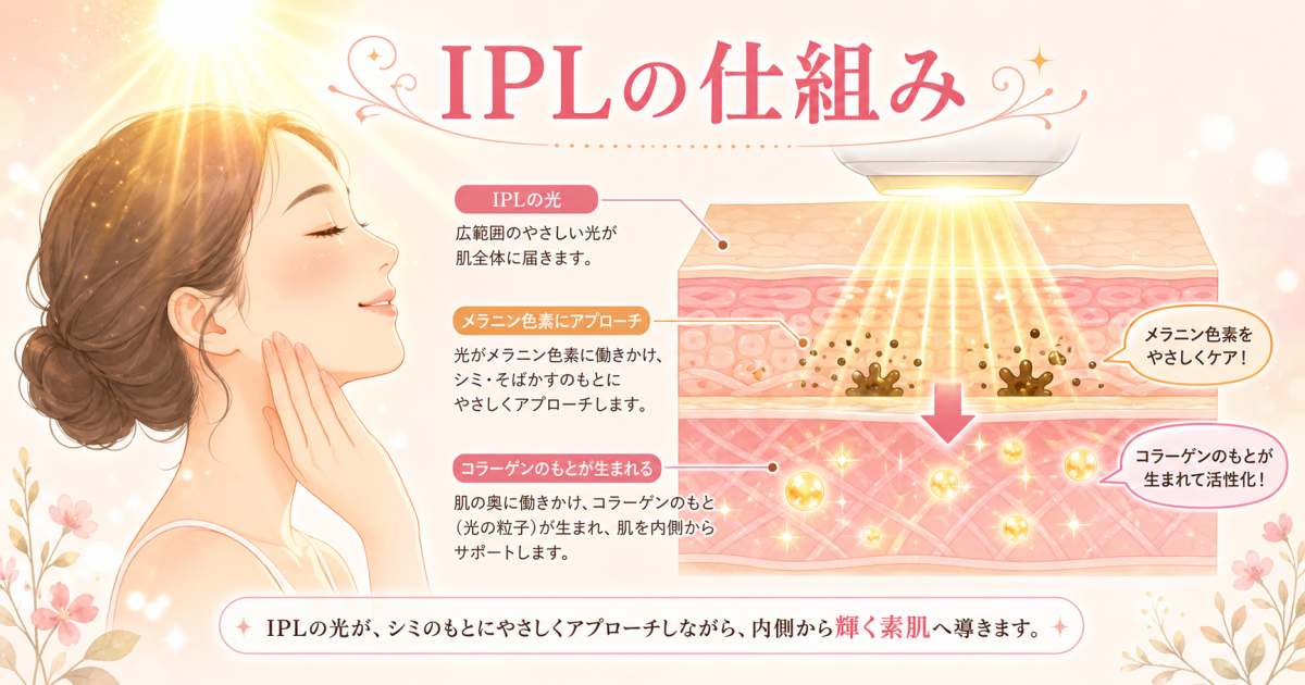 フォトフェイシャルIPLの仕組みとシミ・毛穴へのアプローチ