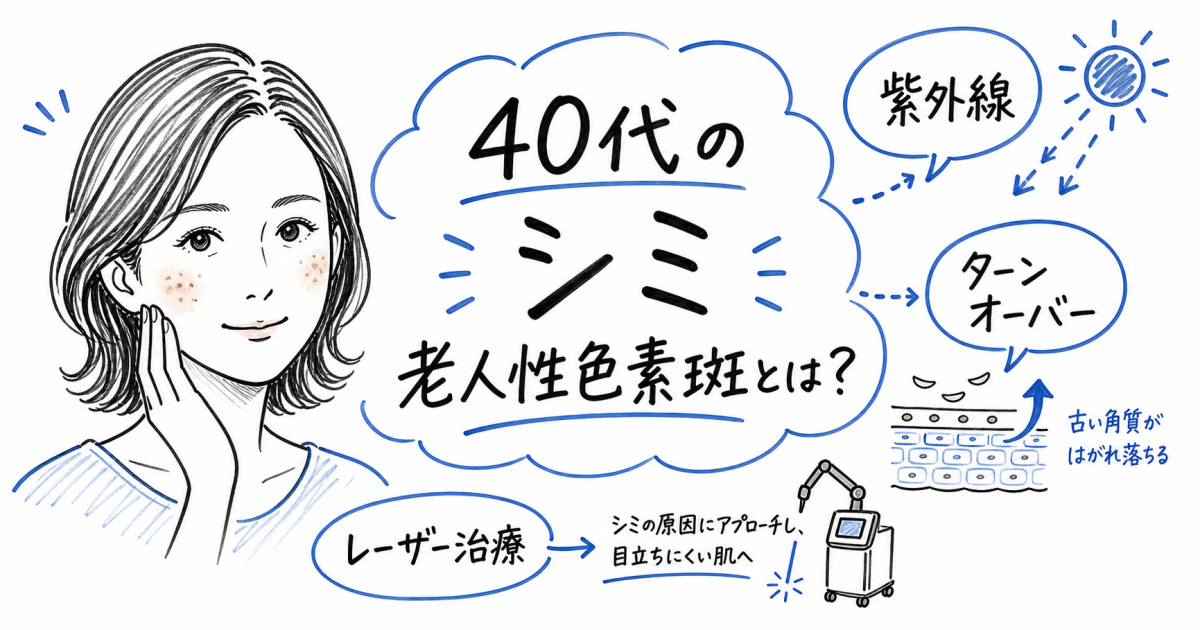 40代のシミの原因とは？老人性色素斑の特徴と治療法を解説